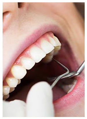 Tooth Extraction Near Me in Stafford, TX